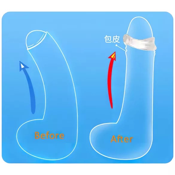 Silikon Eichelring - Ejakulationsverzögerung (transparent)